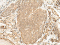 VPS50 Polyclonal Antibody – Figure 1 of 3