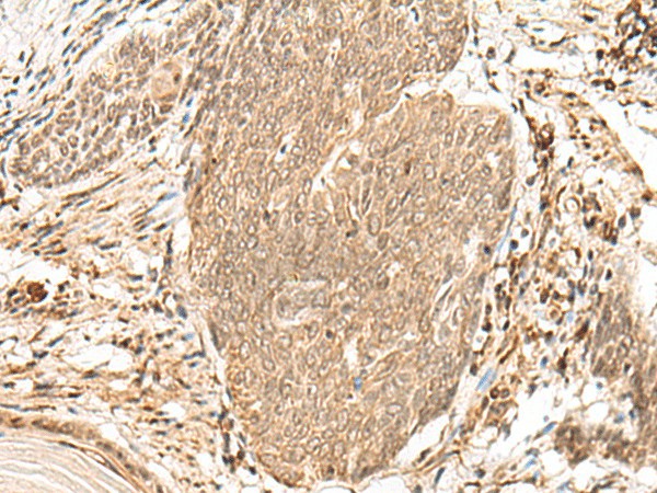 VPS50 Polyclonal Antibody – Figure 1 of 3