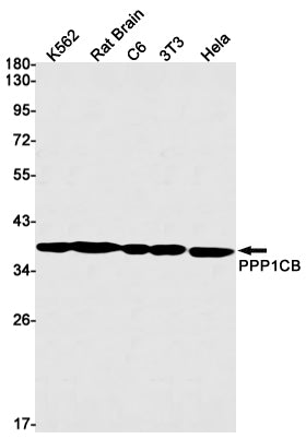 Recombinant PP1C beta Monoclonal Antibody – Figure 1 of 4