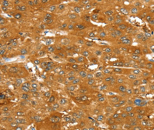 ABCC9 Polyclonal Antibody – Figure 1 of 3