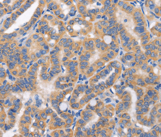 CARD17 Polyclonal Antibody – Figure 1 of 3