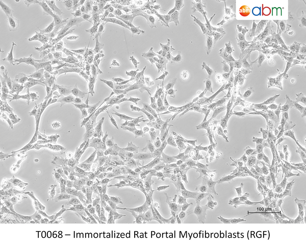 Immortalized Rat Portal Myofibroblasts (RGF) – Figure 1 of 1