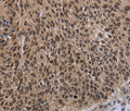 DLX4 Polyclonal Antibody – Figure 1 of 3