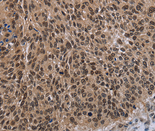 DLX4 Polyclonal Antibody – Figure 1 of 3