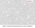 Superficial Spreading Melanoma Cell Line (MM052) | Applied Biological Materials (abm)
