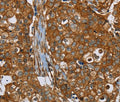 PLEC Polyclonal Antibody – Figure 1 of 2
