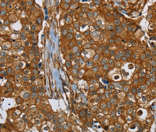 PLEC Polyclonal Antibody – Figure 1 of 2