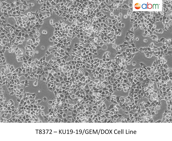 KU19-19/GEM/DOX Cell Line | Applied Biological Materials (abm)