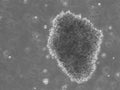 B-LCL-HROC75 cell