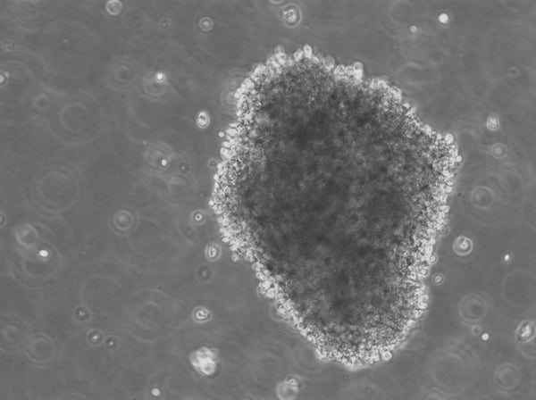 B-LCL-HROC75 cell