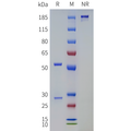 Anti-TRBV9(seniprutug biosimilar) mAb – Figure 1 of 1