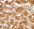 CPB1 Polyclonal Antibody – Figure 1 of 4