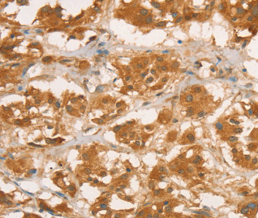 CPB1 Polyclonal Antibody – Figure 1 of 4