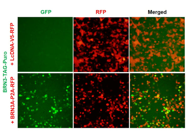 BRN3 Reporter Lentivirus – Figure 1