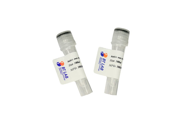 53BP1(Phospho-Ser1778) Rabbit Polyclonal Antibody – Figure 1 of 1