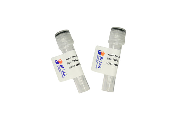 A0A3Q3A7D8 Rabbit Polyclonal Antibody – Figure 1 of 1