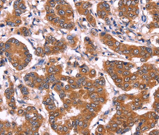 COL20A1 Polyclonal Antibody – Figure 1 of 3