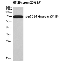 Phospho-p70 S6 kinase alpha (Ser418) Polyclonal Antibody – Figure 1 of 2