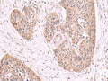 MGP Polyclonal Antibody – Figure 1 of 2