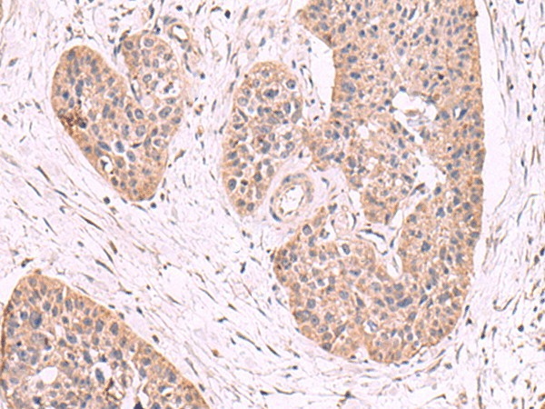 MGP Polyclonal Antibody – Figure 1 of 2