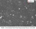 Immortalized Fetal Sheep Hippocampal Neuron Cells - SV40 | Applied Biological Materials (abm)