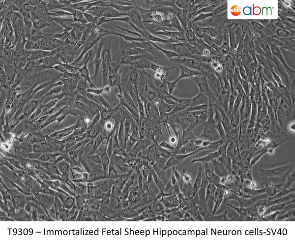Immortalized Fetal Sheep Hippocampal Neuron Cells - SV40 | Applied Biological Materials (abm)