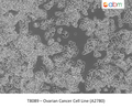 Ovarian Cancer Cell Line (A2780) | Applied Biological Materials (abm)