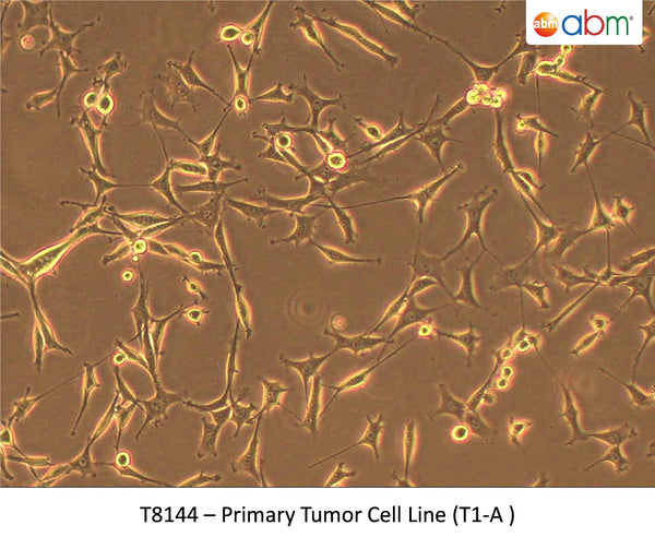 Primary Tumor Cell Line (T1-A ) | Applied Biological Materials (abm)