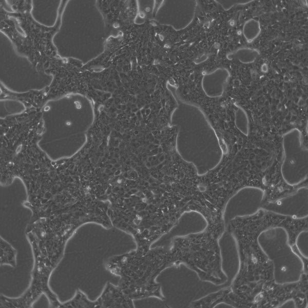 Capan-1 cell