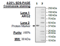 ARG2, His-Tag Recombinant – Figure 1 of 2