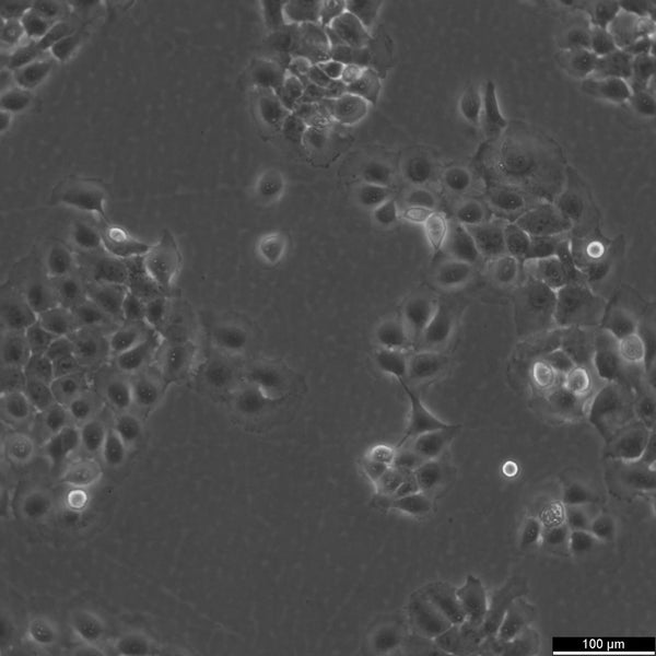 CaSki cell
