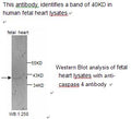 Anti-Caspase 4 Antibody – Figure 1 of 1
