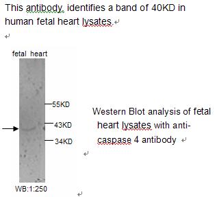 Anti-Caspase 4 Antibody – Figure 1 of 1