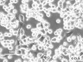 CERV-186 cell