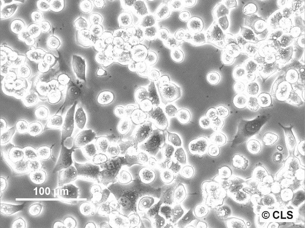 CERV-186 cell