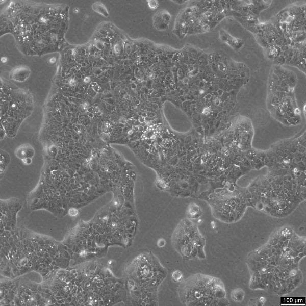 CERV-196 cell