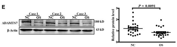 ADAMTS7 Antibody – Figure 1 of 1