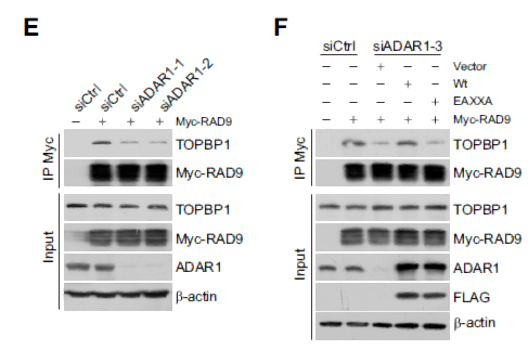 ADAR1 links R-loop homeostasis to ATR activation in replication stress response. NUCLEIC ACIDS RESEARCH Lei Shi WB, STJ96904