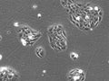 Colo-680N cell