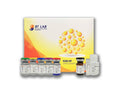 Human Tuberculosis (Tb) Antibody IgG, TB Ab IgG ELISA Kit