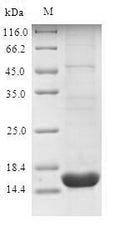 Recombinant Human Sodium-dependent phosphate transport protein 2B (SLC34A2), partial – Figure 1 of 1