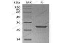 Recombinant Human NEDD8 Protein (His Tag, SUMO Tag) – Figure 1 of 2