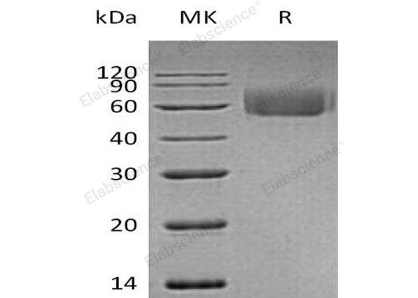 Recombinant Human IL-1RL2 Protein (His Tag) – Figure 1 of 2