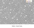 THJ21T Cells – Figure 1 of 1
