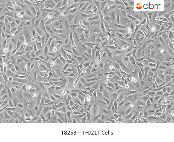 THJ21T Cells – Figure 1 of 1