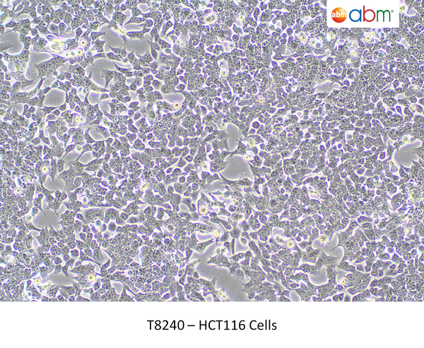 HCT116 Cells – Figure 1 of 1