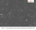 Immortalized Human Colonic Epithelial Cells (HCEC-1CT) | Applied Biological Materials (abm)