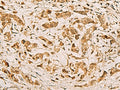 ZMAT4 Polyclonal Antibody – Figure 1 of 2