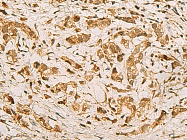 ZMAT4 Polyclonal Antibody – Figure 1 of 2