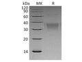 Recombinant Human Ephrin-B2/EFNB2 Protein (His Tag) – Figure 1 of 2